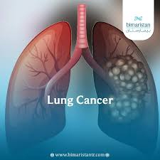 Prostate cancer clinical trial research