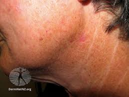 Surgical research